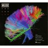 MUSE THE 2ND LAW CD+DVD Digisleeve CD